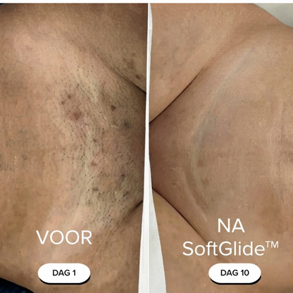 SoftGlide™