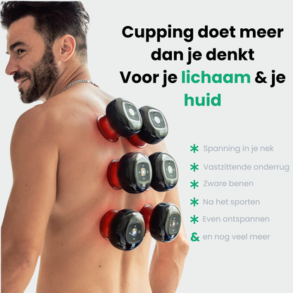 PulseCup™ Cupping Massage Apparaat